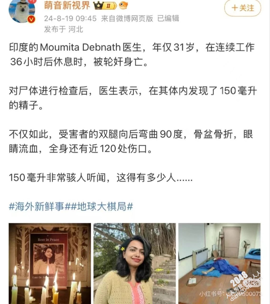 印度女医生值夜班时惨遭奸杀!医生在体内发现了150毫升精液 远超单个男性正常排出的10毫升!